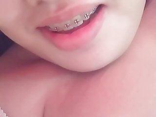 Junges Mädchen mit Zahnspange vor Webcam